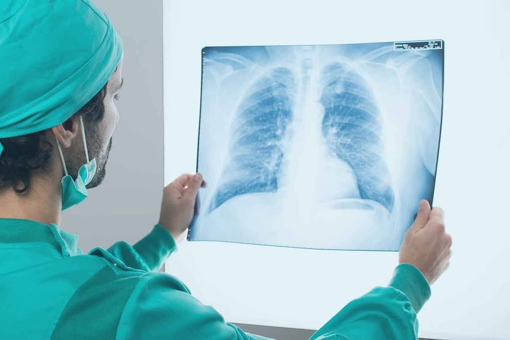 ¿Qué es la Fisioterapia Respiratoria o Fisioterapia Pulmonar? ¿Qué es la Fisioterapia Respiratoria o Fisioterapia Pulmonar?